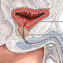 前列腺按摩法简介  什么情况下需要按摩