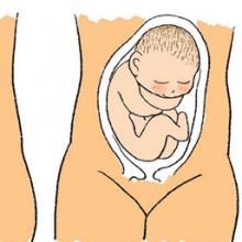 胎位不正是什么原因 主要有三个方面