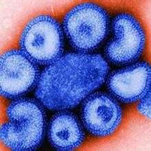 甲型h1n1流感病毒及其易感人群介绍