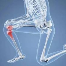 膝关节在哪 膝关节炎的定义是什么